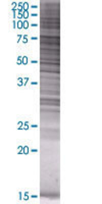 ACSL3 transfected lysate.