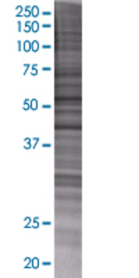 CYP4F12 transfected lysate.