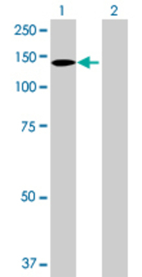 Lane 1: SSH1 transfected lysate (115.5 KDa) Lane 2: Non-transfected lysate.