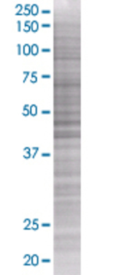 CALR3 transfected lysate.