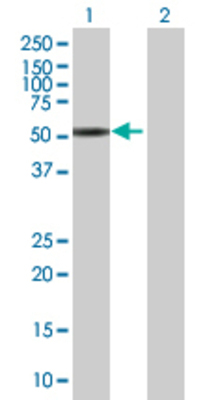 Lane 1: PIP5K2C transfected lysate (46.42 KDa) Lane 2: Non-transfected lysate.