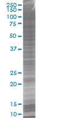 GM2A transfected lysate