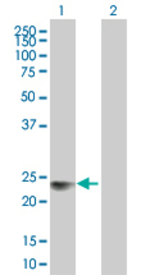 Lane 1: GM2A transfected lysate (21.34 KDa). Lane 2: Non-transfected lysate.
