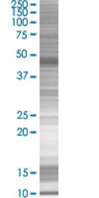 TEKT1 transfected lysate.
