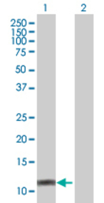 Lane 1: CKS1B transfected lysate (8.69 KDa) Lane 2: Non-transfected lysate.