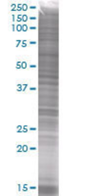 CKS1B transfected lysate.