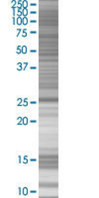 NR0B2 transfected lysate.