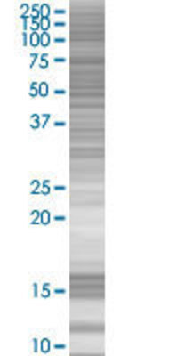 CD86 transfected lysate.