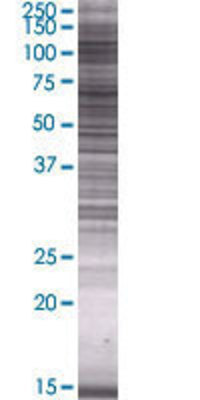 FA2H transfected lysate.