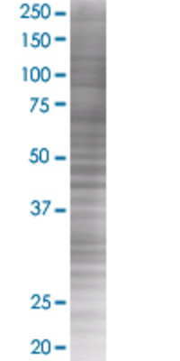BRMS1 transfected lysate.
