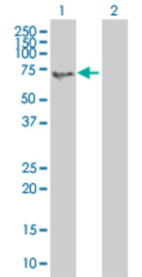 Lane 1: FEZ1 transfected lysate (43.23 KDa). Lane 2: Non-transfected lysate.