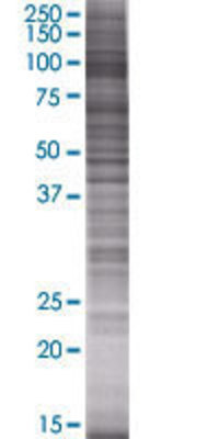 ITIH1 transfected lysate.