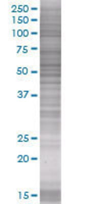 KRT8 transfected lysate.