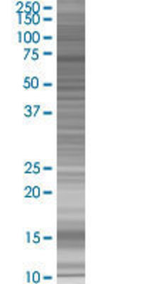 TAF1B transfected lysate.