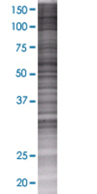 DDX19B transfected lysate.