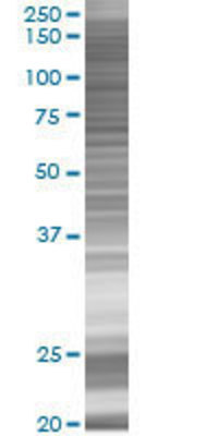 KEL transfected lysate.
