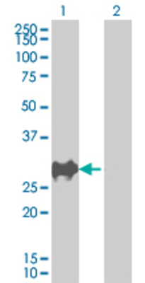 Lane 1: CDKN1B transfected lysate (21.89 KDa). Lane 2: Non-transfected lysate.