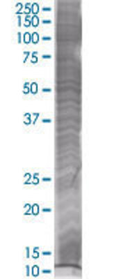 SSBP2 transfected lysate