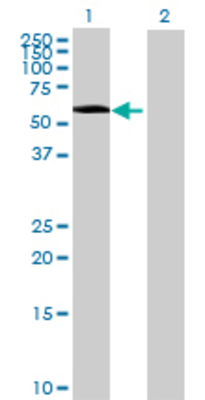 Lane 1: ICA1L transfected lysate (53.13 KDa) Lane 2: Non-transfected lysate.
