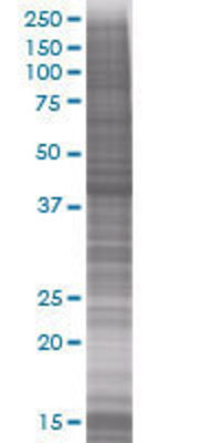 KRT19 transfected lysate.