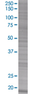MPHOSPH6 transfected lysate