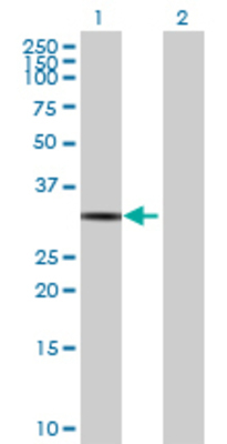 Lane 1: DHRS3 transfected lysate (33.33 KDa) Lane 2: Non-transfected lysate.
