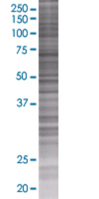 SFXN3 transfected lysate.