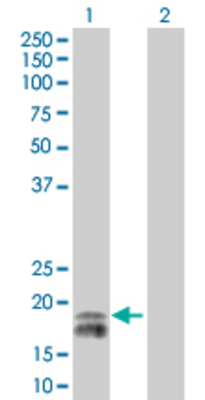 Lane 1: EDN2 transfected lysate (20 KDa). Lane 2: Non-transfected lysate.