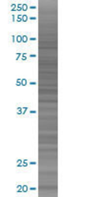 EPB41L4A transfected lysate.