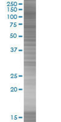 RECK transfected lysate.