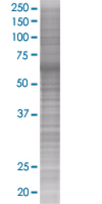 CD59 transfected lysate.
