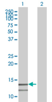 Lane 1: PCBD2 transfected lysate (14.2 KDa) Lane 2: Non-transfected lysate.