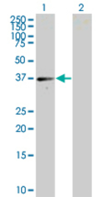 Lane 1: UNG transfected lysate (33.9 KDa) Lane 2: Non-transfected lysate.