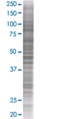 UNG transfected lysate.