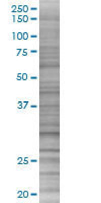 SERPINA6 transfected lysate.