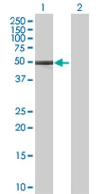 Lane 1: SERPINA6 transfected lysate (44.66 KDa) Lane 2: Non-transfected lysate.