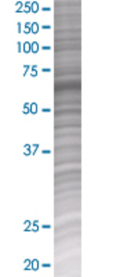 UHRF2 transfected lysate.