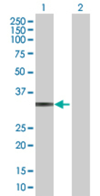 Lane 1: ITGB1BP1 transfected lysate (22.11 KDa) Lane 2: Non-transfected lysate.