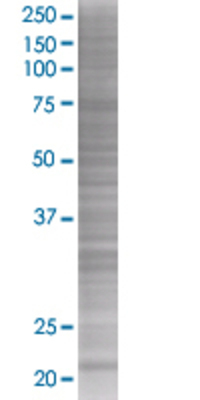 ITGB1BP1 transfected lysate.