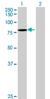 Lane 1: NCSTN transfected lysate (75.9 KDa) Lane 2: Non-transfected lysate.