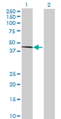 Lane 1: FUT3 transfected lysate (39.82 KDa) Lane 2: Non-transfected lysate.