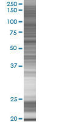 STOML2 transfected lysate.