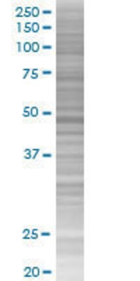 GABPB2 transfected lysate.