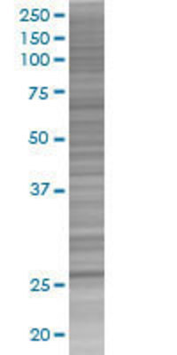 ETFB transfected lysate.