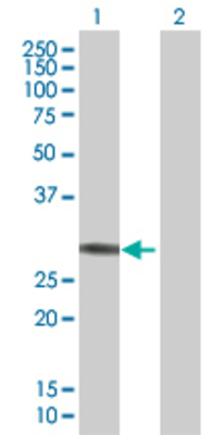 Lane 1: ETFB transfected lysate (27.8 KDa) Lane 2: Non-transfected lysate.
