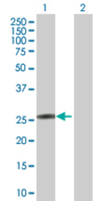 Lane 1: KCNIP4 transfected lysate (27.61 KDa) Lane 2: Non-transfected lysate.