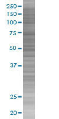 GUCA1C transfected lysate.