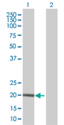 Lane 1: GUCA1C transfected lysate (23.8 KDa) Lane 2: Non-transfected lysate.