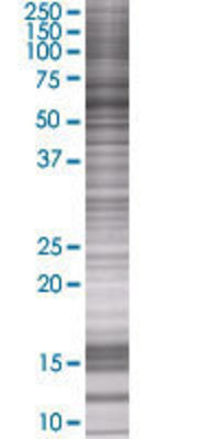 FYN transfected lysate.