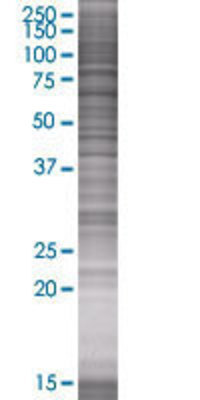 DLAT transfected lysate.